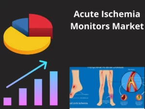 Acute Ischemia Monitors