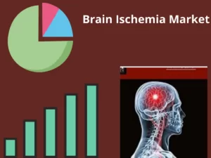 Brain Ischemia Market