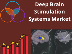 Deep Brain Stimulation Systems Market