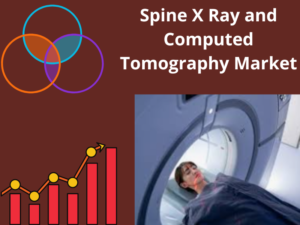 Spine X Ray and Computed Tomography Market