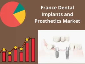 France Dental Implants and Prosthetics market